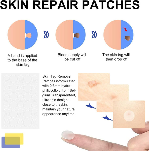 Safe Skin Tag Removal Kit 2-8mm Painless Mole Tag Remover