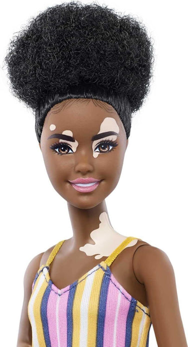 Barbie Fashionistas Doll #135 - Vitiligo Skin, Curly Brunette Hair