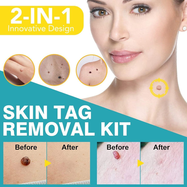 Safe Skin Tag Removal Kit 2-8mm Painless Mole Tag Remover