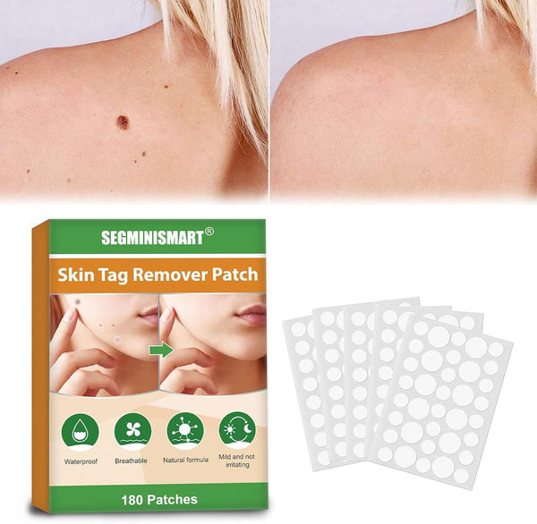 Segminismart Skin Tag Remover Patch 180 Patches Now Get Rid From Tags, Fair Skin