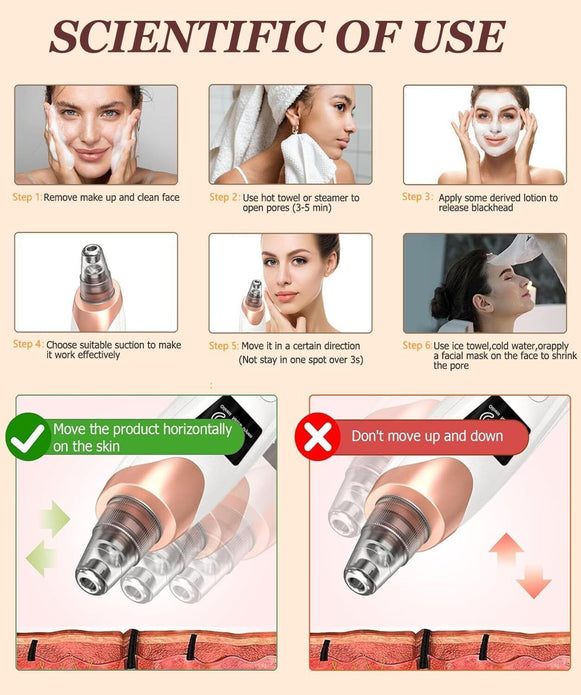 Rechargeable Blackhead Remover Vacuum w/3 Modes & 5 Heads, Whitehead Extractor