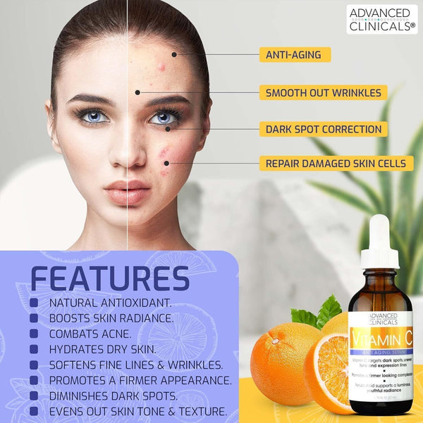 Advanced Clinicals Vitamin C Serum  Anti Aging for Dark Spots 1.75 oz